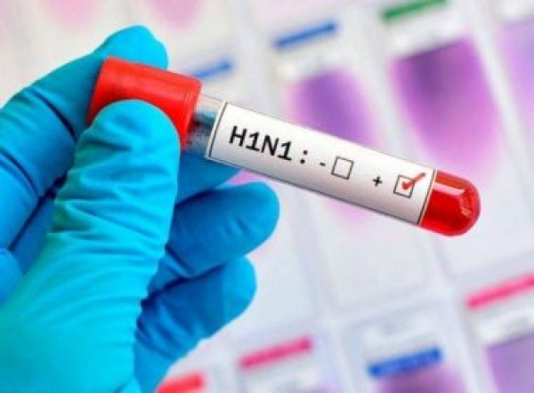 Quase metade das vítimas fatais de H1N1 na BA em 2019 não estava em faixa etária &#039;de risco&#039;