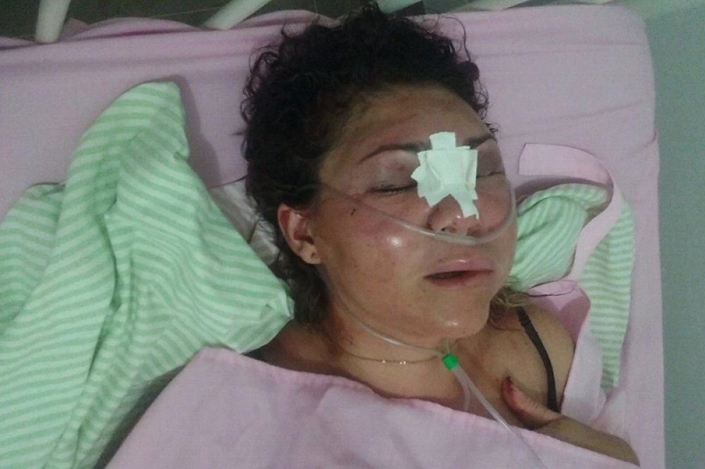 Ibiassucê: Mulher sofre agressão de ex-marido e é encaminhada para o HR em Guanambi
